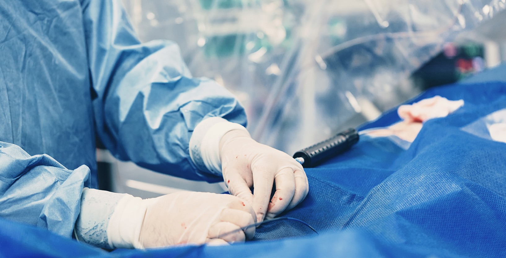 Global Interventional Cardiology Market Report Preview (2024 Update)